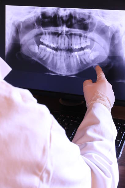 Best Broken or Cracked Tooth Emergency Dentist in Fort Dick, CA