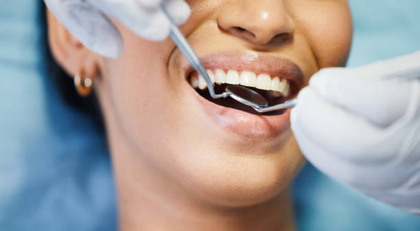 Best Emergency Cosmetic Dentistry in Fort Dick, CA