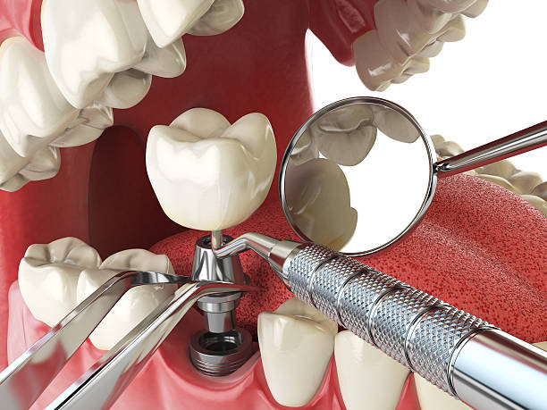 Best Urgent Dental Care for Toothache in Fort Dick, CA